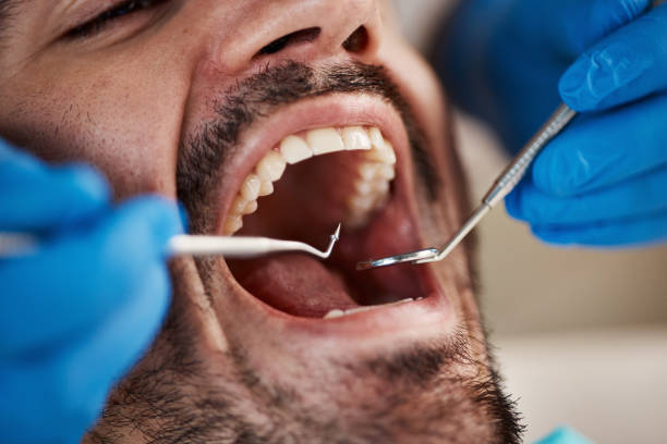 Best Broken or Cracked Tooth Emergency Dentist in Fredonia, AZ